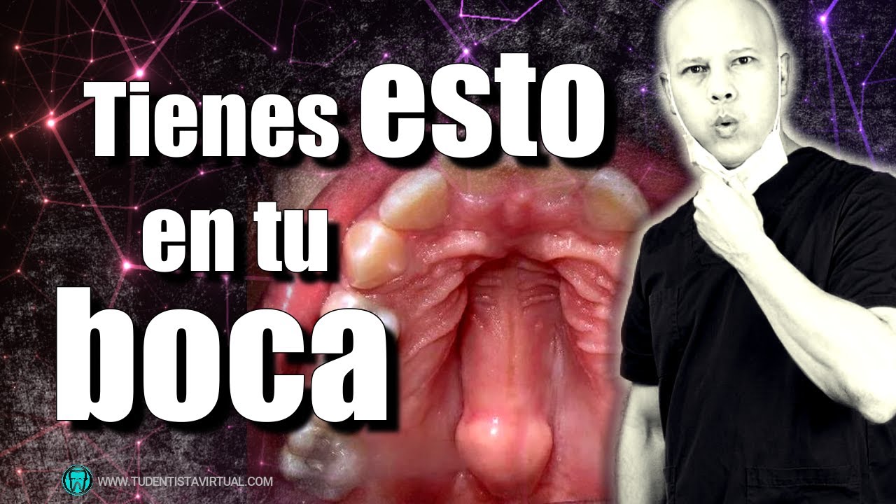 grano en el paladar con dolor