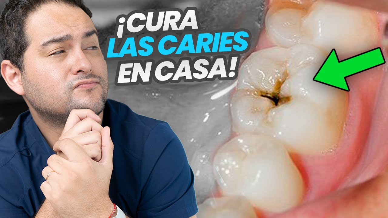 las caries se pueden curar solas