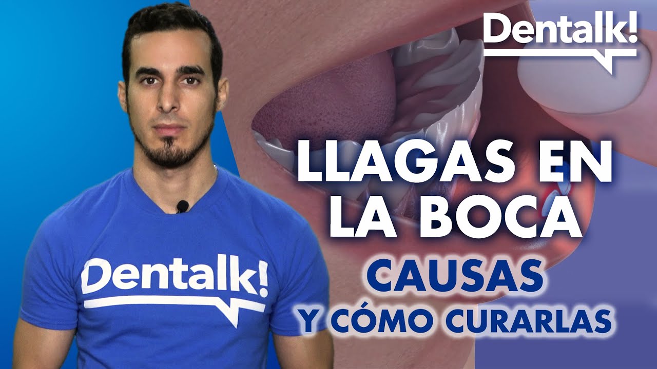 porque salen yagas en la boca