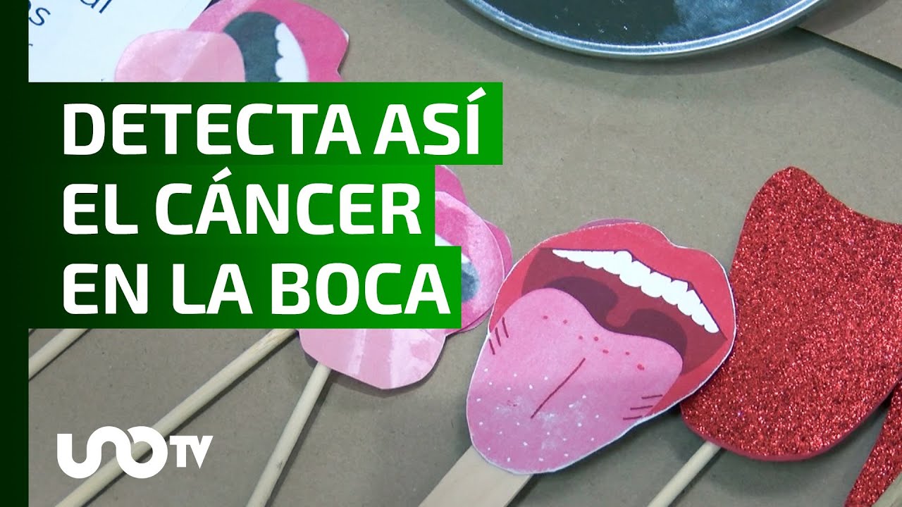 puntos rojos en el cielo de la boca