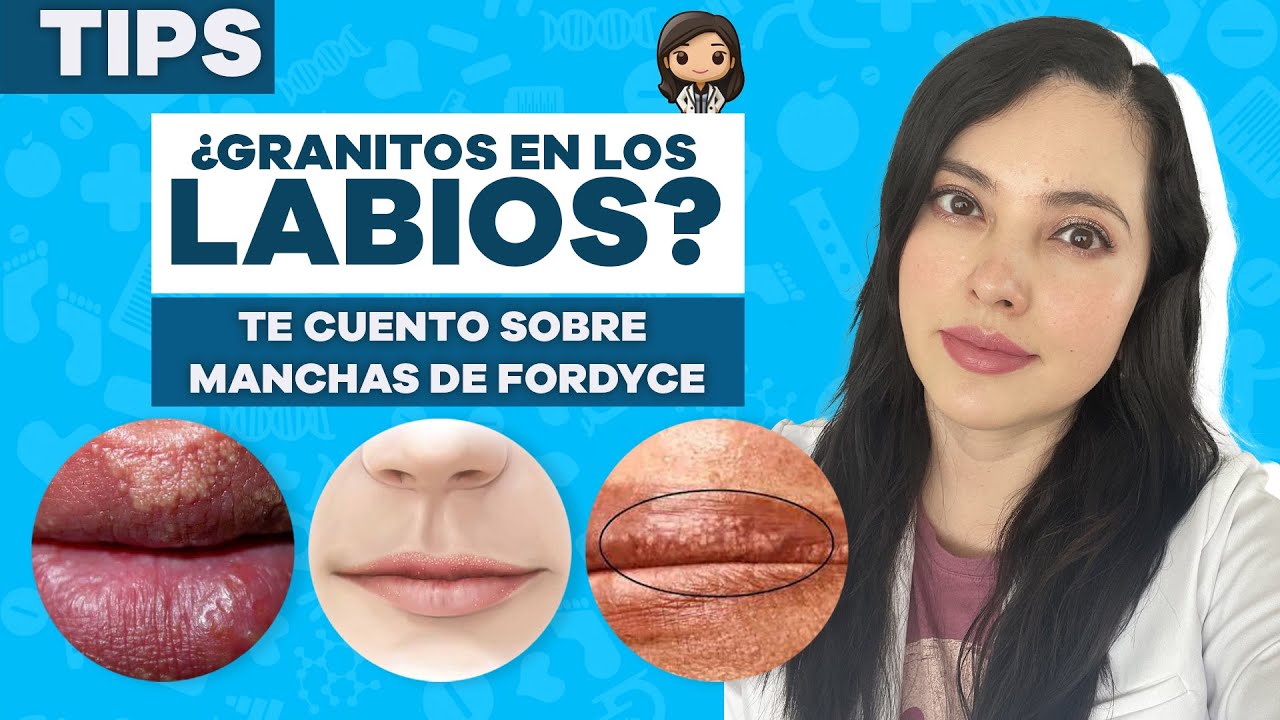 puntos rojos en el labio inferior de la boca