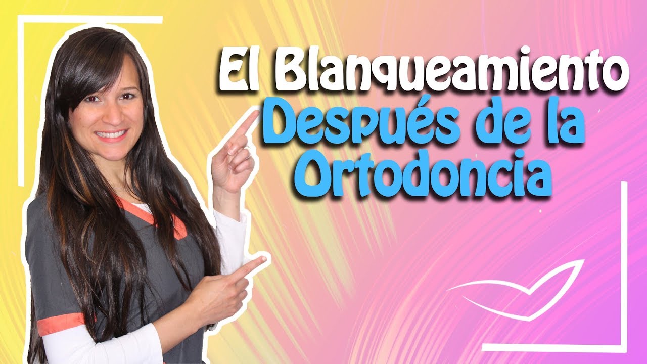 se recomienda el blanqueamiento antes o después de la ortodoncia