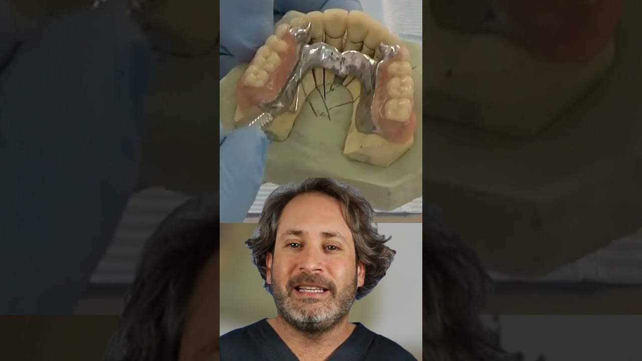 tipos de ataches en prótesis removible